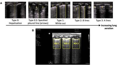 Assessing lung aeration using ultrasound after birth in near-term lambs at risk of respiratory distress